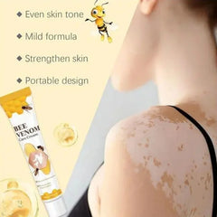 Fivfivgo Bee Venom Vitiligo Treatment Cream | Skin Repair & Hydration